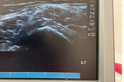Prevenção de patologias músculo-esqueléticas nos médicos dentistas