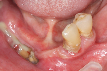 Saúde oral e o seu impacto na saúde geral