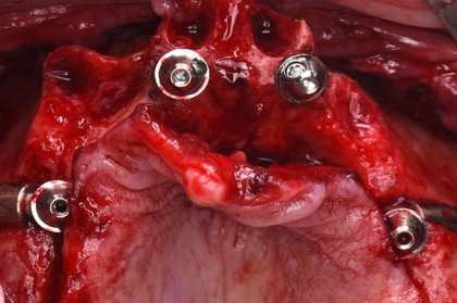 Práticas recomendadas no bloco operatório