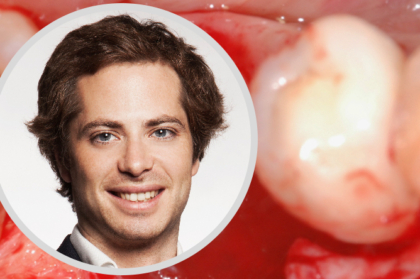 Webinar “Resolução de insucessos em implantologia”: inscrições abertas