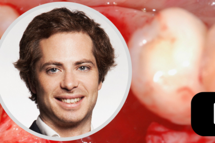 Resolução de insucessos em implantologia