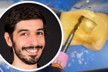 Inscrições abertas no webinar "Endodontia descomplicada: mais eficiência e menos stress com dicas clínicas imediatas"