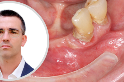 Inscrições abertas no webinar "Saúde oral e o seu impacto na saúde geral"