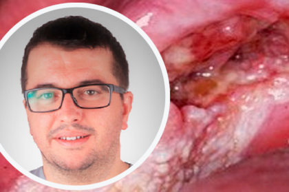 Inscrições abertas no webinar "Diagnosticar Neoplasia Maligna – um desafio constante no exercício da medicina dentária"