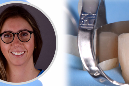 Inscrições abertas no webinar de dentisteria adesiva minimamente invasiva