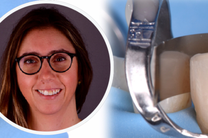 Inscrições abertas no webinar “Da filosofia à prática: dentisteria adesiva minimamente invasiva com consciência clínica”