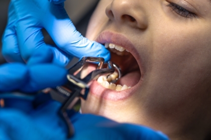 Traumatologia oral da infância à idade adulta: competências essenciais para o médico dentista do século XXI (curso pré-congresso)