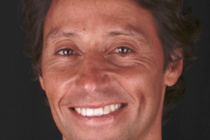 Reabilitações orais extensas - do planeamento à execução