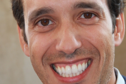 Reabilitações orais extensas - do planeamento à execução