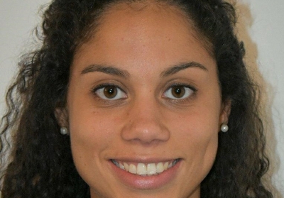 Utilização de protetor bucal em atletas da Seleção Portuguesa de Râguebi