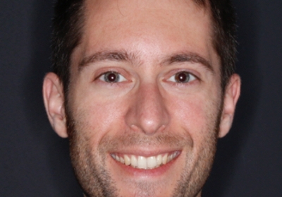 Ulectomia na retenção prolongada de um molar superior permamente: A propósito de um caso clínico