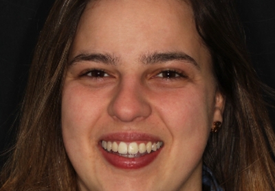 Diagnóstico diferencial de lesões do lábio inferior: caso clínico