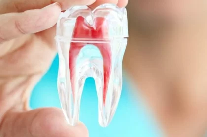 Hands-on de endodontia e perfurações