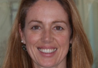 Marsupialização de quisto dentígero em dentição mista - caso clínico