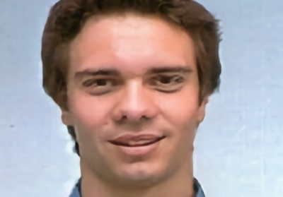 Encerramento de comunicação oroantral com bola de Bichat – caso clínico