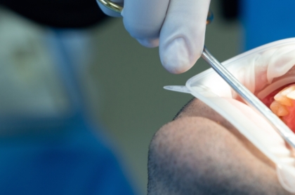 Hands-on "Desafios e soluções na reabilitação dos sectores posteriores da maxila - colocação de implantes com sinus-lift" (manhã)