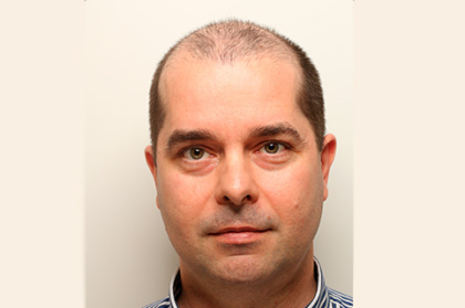 Integrated treatment of gummy smile: approach with orthodontics and orthognathic surgery