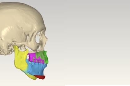 Hands-on "Cirurgia ortognática atual para o ortodontista" (tarde)